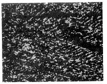 图3　失效模具试样残留铸态树枝状偏析　×40